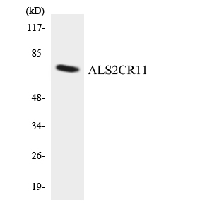 ALS2CR11 Antibody - Western blot analysis of the lysates from COLO205 cells using ALS2CR11 antibody.