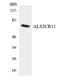 ALS2CR11 Antibody - Western blot analysis of the lysates from COLO205 cells using ALS2CR11 antibody.