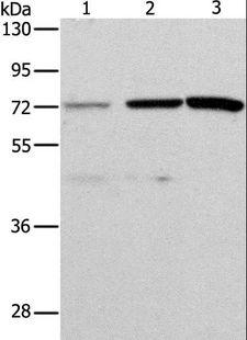 ALS2CR11 Antibody - Western blot analysis of HeLa and SKOV3 cell, mouse liver tissue, using ALS2CR11 Polyclonal Antibody at dilution of 1:500.