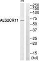 ALS2CR11 Antibody - Western blot analysis of extracts from NIH/3T3 cells, using ALS2CR11 antibody.