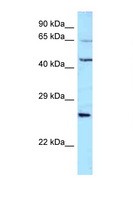 ALS2CR11 Antibody - ALS2CR11 antibody Western blot of 721_B Cell lysate. Antibody concentration 1 ug/ml.  This image was taken for the unconjugated form of this product. Other forms have not been tested.