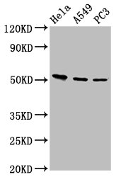 ALS2CR12 Antibody - Positive Western Blot detected in Hela whole cell lysate, A549 whole cell lysate, PC3 whole cell lysate. All lanes: ALS2CR12 antibody at 12 µg/ml Secondary Goat polyclonal to rabbit IgG at 1/50000 dilution. Predicted band size: 53, 50 KDa. Observed band size: 53 KDa