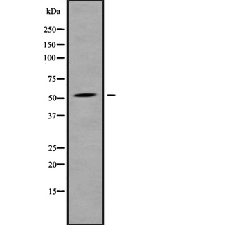 ALS2CR12 Antibody - Western blot analysis of ALS2CR12 using COLO205 whole cells lysates