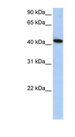 ALS2CR15 / ICA1L Antibody - ICA1L antibody Western blot of HepG2 cell lysate. This image was taken for the unconjugated form of this product. Other forms have not been tested.