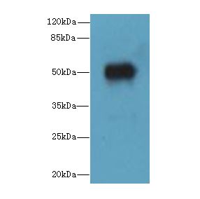 ALS2CR15 / ICA1L Antibody - Western blot. All lanes: ICA1L antibody at 1.2 ug/ml+ MCF7 whole cell lysate Goat polyclonal to rabbit at 1:10000 dilution. Predicted band size: 54 kDa. Observed band size: 54 kDa.