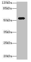 ALS2CR15 / ICA1L Antibody - Western blot All lanes: ICA1L antibody at 1.2µg/ml + MCF-7 whole cell lysate Secondary Goat polyclonal to rabbit IgG at 1/10000 dilution Predicted band size: 55, 22 kDa Observed band size: 55 kDa