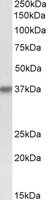 ALX / HSH2D Antibody - HSH2D antibody (0.3 ug/ml) staining of K562 lysate (35 ug protein/ml in RIPA buffer). Primary incubation was 1 hour. Detected by chemiluminescence.