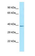 ALX / HSH2D Antibody - ALX / HSH2D antibody Western Blot of COLO205.  This image was taken for the unconjugated form of this product. Other forms have not been tested.