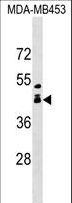 ALX1 Antibody - ALX1 Antibody western blot of MDA-MB453 cell line lysates (35 ug/lane). The ALX1 antibody detected the ALX1 protein (arrow).