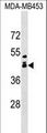 ALX1 Antibody - ALX1 Antibody western blot of MDA-MB453 cell line lysates (35 ug/lane). The ALX1 antibody detected the ALX1 protein (arrow).