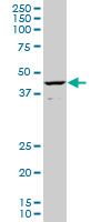 ALX1 Antibody - CART1 monoclonal antibody (M02), clone 2A10. Western Blot analysis of CART1 expression in HeLa NE.