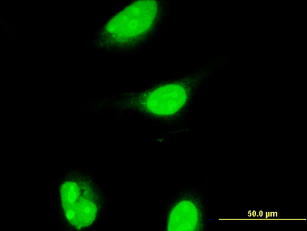 ALX1 Antibody - Immunofluorescence of monoclonal antibody to ALX1 on HeLa cell . [antibody concentration 10 ug/ml]
