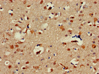 ALX1 Antibody - Immunohistochemistry of paraffin-embedded human brain tissue at dilution of 1:100