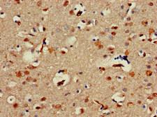 ALX1 Antibody - Immunohistochemistry of paraffin-embedded human brain tissue at dilution of 1:100