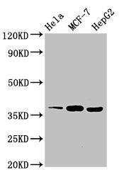 ALX1 Antibody - Western Blot Positive WB detected in:Hela whole cell lysate,MCF-7 whole cell lysate,HepG2 whole cell lysate All Lanes:ALX1 antibody at 3µg/ml Secondary Goat polyclonal to rabbit IgG at 1/50000 dilution Predicted band size: 37 KDa Observed band size: 37 KDa