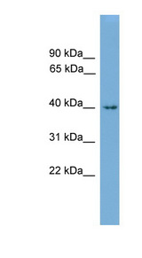 ALX1 Antibody - ALX1 antibody Western blot of Mouse Heart lysate. This image was taken for the unconjugated form of this product. Other forms have not been tested.