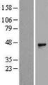 ALX1 Protein - Western validation with an anti-DDK antibody * L: Control HEK293 lysate R: Over-expression lysate