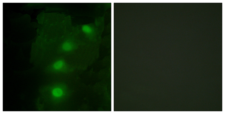 ALX3 Antibody - Immunofluorescence analysis of HeLa cells, using ALX3 Antibody. The picture on the right is blocked with the synthesized peptide.