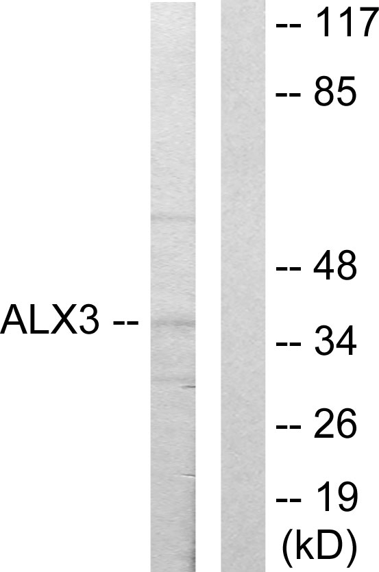 ALX3 Antibody - Western blot analysis of lysates from 293 cells, using ALX3 Antibody. The lane on the right is blocked with the synthesized peptide.