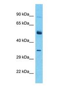 ALX3 Antibody - Western blot of ALX3 Antibody with human Thymus Tumor lysate.  This image was taken for the unconjugated form of this product. Other forms have not been tested.