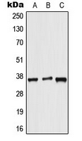 ALX3 Antibody - Western blot analysis of ALX3 expression in HeLa (A); NIH3T3 (B); rat brain (C) whole cell lysates.