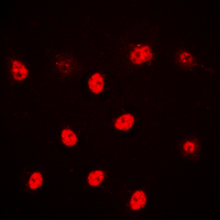 ALX3 Antibody - Immunofluorescent analysis of ALX3 staining in HeLa cells. Formalin-fixed cells were permeabilized with 0.1% Triton X-100 in TBS for 5-10 minutes and blocked with 3% BSA-PBS for 30 minutes at room temperature. Cells were probed with the primary antibody in 3% BSA-PBS and incubated overnight at 4 C in a humidified chamber. Cells were washed with PBST and incubated with a DyLight 594-conjugated secondary antibody (red) in PBS at room temperature in the dark. DAPI was used to stain the cell nuclei (blue).