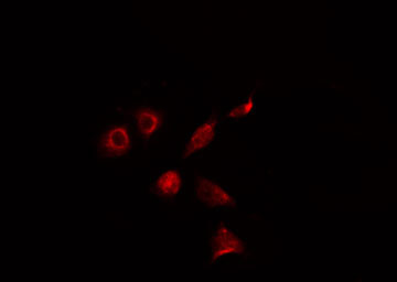 ALX3 Antibody - Staining 293 cells by IF/ICC. The samples were fixed with PFA and permeabilized in 0.1% Triton X-100, then blocked in 10% serum for 45 min at 25°C. The primary antibody was diluted at 1:200 and incubated with the sample for 1 hour at 37°C. An Alexa Fluor 594 conjugated goat anti-rabbit IgG (H+L) antibody, diluted at 1/600, was used as secondary antibody.