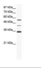 ALX4 Antibody - HepG2 Cell Lysate.  This image was taken for the unconjugated form of this product. Other forms have not been tested.