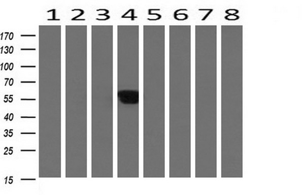ALX4 Antibody - Western blot of extracts (10ug) from 8 Human tissue by using anti-ALX4 monoclonal antibody at 1:200 (1: Testis; 2: Uterus; 3: Breast; 4: Brain; 5: Liver; 6: Ovary; 7: Thyroid gland; 8: Colon).