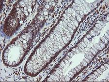 ALX4 Antibody - IHC of paraffin-embedded Human colon tissue using anti-ALX4 mouse monoclonal antibody.