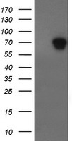 ALX4 Antibody - HEK293T cells were transfected with the pCMV6-ENTRY control (Left lane) or pCMV6-ENTRY ALX4 (Right lane) cDNA for 48 hrs and lysed. Equivalent amounts of cell lysates (5 ug per lane) were separated by SDS-PAGE and immunoblotted with anti-ALX4.