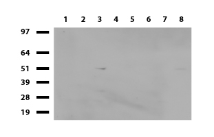 ALX4 Antibody - Western blot of cell lysates. (35ug) from 8 different cell lines. (1: HepG2, 2: HeLa, 3: SV-T2, 4: MCF7, 5: COS7, 6: Jurkat, 7: MDCK, 8: PC-12). Diluation: 1:500.