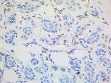 ALX4 Antibody - Immunohistochemical staining of FFPE human breast tissue section using anti-ALX4 mouse monoclonal antibody clone UMAB118 at 1:200. (Heat-induced epitope retrieval by Tris-EDTA, pH9.0; Polink1 Broad HRP for 15 min; DAB chromogen for 5 min & DAB enhancer for 30 sec).