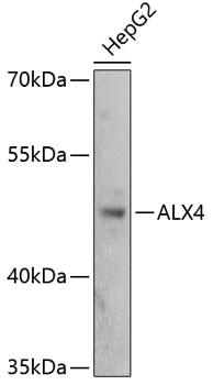 ALX4 Antibody - Western blot analysis of extracts of HepG2 cells using ALX4 Polyclonal Antibody at dilution of 1:3000.