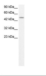 ALX4 Antibody - Jurkat Cell Lysate.  This image was taken for the unconjugated form of this product. Other forms have not been tested.