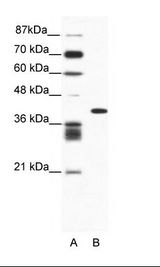 ALX4 Antibody - A: Marker, B: Jurkat Cell Lysate.  This image was taken for the unconjugated form of this product. Other forms have not been tested.