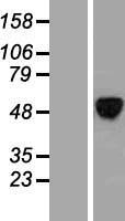 ALX4 Protein - Western validation with an anti-DDK antibody * L: Control HEK293 lysate R: Over-expression lysate