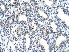 ALY / THOC4 Antibody - THOC4 antibody ARP43055_T100-NP_005773-THOC4(THO complex 4) Antibody was used in IHC to stain formalin-fixed, paraffin-embedded human lung.  This image was taken for the unconjugated form of this product. Other forms have not been tested.
