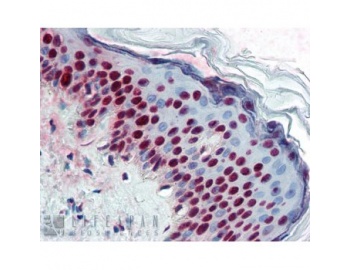 ALY / THOC4 Antibody - Immunohistochemistry showing Anti-ALY on formalin fixed paraffin embedded skin tissue