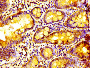 ALY / THOC4 Antibody - Immunohistochemistry image of paraffin-embedded human small intestine tissue at a dilution of 1:100