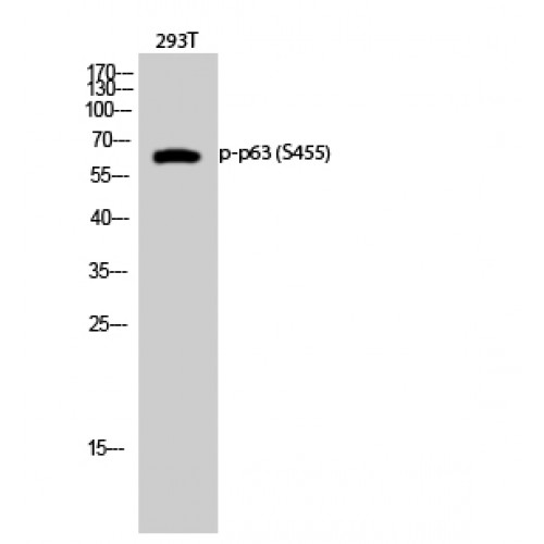 AMACR / P504S Antibody - Western blot of Phospho-p63 (S455) antibody
