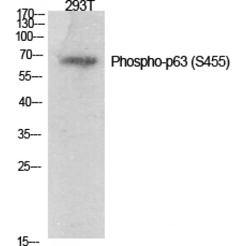 AMACR / P504S Antibody - Western blot of Phospho-p63 (S455) antibody