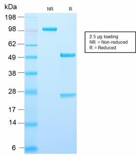 AMACR / P504S Antibody - SDS-PAGE Analysis Purified Recombinant Rabbit Monoclonal Antibody (AMACR/2748R)Confirmation of Purity and Integrity of Antibody.