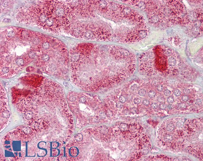 AMACR / P504S Antibody - Anti-AMACR antibody IHC of human kidney. Immunohistochemistry of formalin-fixed, paraffin-embedded tissue after heat-induced antigen retrieval. Antibody concentration 5 ug/ml.  This image was taken for the unconjugated form of this product. Other forms have not been tested.