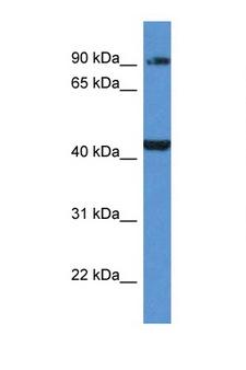 AMACR / P504S Antibody - AMACR antibody Western blot of 721_B Cell lysate. Antibody concentration 1 ug/ml. This image was taken for the unconjugated form of this product. Other forms have not been tested.