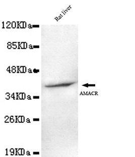 AMACR / P504S Antibody - AMACR (C-terminus) antibody at 1/1000 dilution Rat Liver lysate 40 ug/Lane.