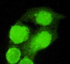 AMACR / P504S Antibody - Immunocytochemistry of HeLa cells using anti- AMACR (C-terminus) antibody diluted 1:150.