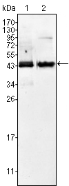 AMACR / P504S Antibody - Western blot using AMACR mouse monoclonal antibody against Jurkat (1) and LNCaP (2) cell lysate.