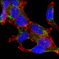 AMACR / P504S Antibody - Confocal immunofluorescence of LNCaP cells using AMACR mouse monoclonal antibody (green). Red: Actin filaments have been labeled with DY-554 phalloidin. Blue: DRAQ5 fluorescent DNA dye.