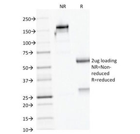 AMACR / P504S Antibody - SDS-PAGE Analysis of Purified, BSA-Free AMACR Antibody (clone AMACR/1723). Confirmation of Integrity and Purity of the Antibody.